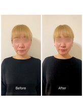 チル(Chill.)/美容整体×小顔整顔で効果大！