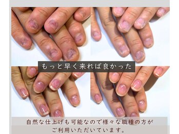 こんな爪で大丈夫かな？