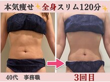 マール(Mar)/ビフォーアフター/痩身/くびれ