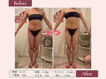 リムサロン(RIMSALON)/