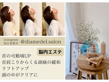 ディアメデル(Diamedel)の写真
