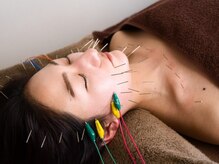 ワームリー 久留米(warmly)/首周りに電気を流すのは当店だけ