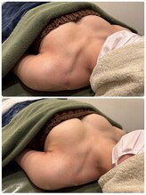 ビープラス(B+)/30代before/after