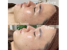 シャルム(Charme.)/