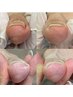 【フットのお悩み解消】初回のメニューに悩んだらこちらを選択!!  　120分 