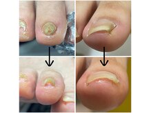 チェンジ(CHANGE)の雰囲気（器具使用なしで初日に辛さがなくなる方多数！当日駆け込み可能◎）