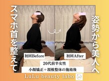 ルルラボ(LuLu beauty labo)/スマホ首卒業で横顔美人