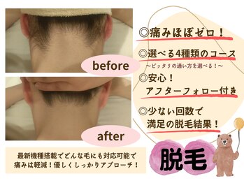 アンドモア(&more)/気になる箇所のパーツ脱毛が人気