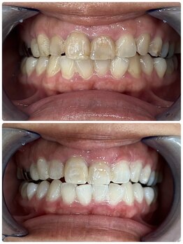 シャイニー 仙台駅東口(SHINY)/お客様の変化