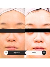 ゆう/ビフォーアフター