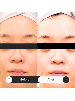 ゆう/ビフォーアフター