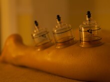 ティール(Teal)/ふくらはぎにもカッピング