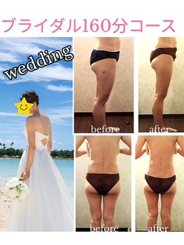 バービーホリック(barbie holic)/４０代　ブライダルエステ