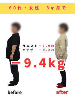 佐々木整骨院/ダイエット終了【60代女性】