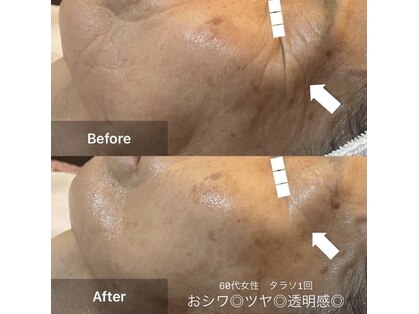 ルーチェ(LUCE)の写真