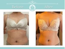 美人バスト 新潟店/ 【バストアップ★育乳】症例