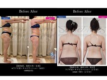 ビューティフルミー(Beautiful Me)の雰囲気（痩せたい部分を集中施術/二の腕・はみ肉/全身施術◎/美肌脱毛◎）