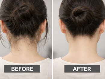 サロンドソレア(salon de solea)の写真/【熱さ/痛みを最小限に★最新LED脱毛で叶える快適美肌♪】ベテランスタッフによるマンツーマン施術で安心◎
