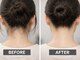 サロンドソレア(salon de solea)の写真/【熱さ/痛みを最小限に★最新LED脱毛で叶える快適美肌♪】ベテランスタッフによるマンツーマン施術で安心◎