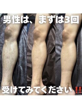 カナウ(KANAU)の写真/【30代以降の男性来店増えてます♪】 毛や肌のお手入れが苦手でも、清潔感のある印象を目指したい男性へ。