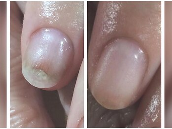 プレシャスハート 広島(Precious Heart)/自爪育成