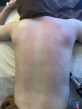 リベル(Liber)/肩や首のつらい所は