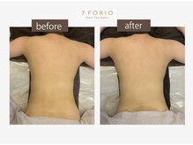 セブンフォリオ(7FORIO)/肌がととのう