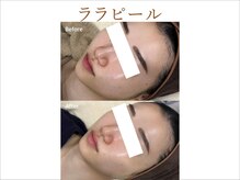 ティアム バイ テトテ 神戸三宮(TIAM by tetote)/ララピール