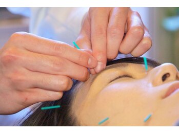 レメディ/美容鍼コース