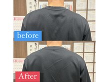 ナオル整体 宮崎院(NAORU整体)/20代男性施術事例【肩の左右差】