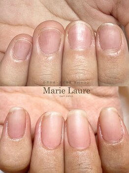 深爪矯正/自爪育成/ネイルケア