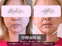 美容整体サロン ココボディ(COCOBODY)