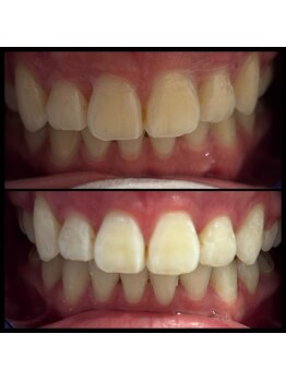 ホヌオラ(Honu Ola)/「1回でも効果が出る」と評判♪