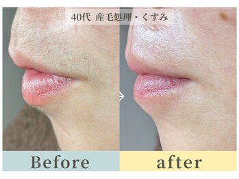 ムク(Muqu.)/お口周りもスッキリ！