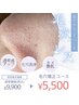 【初回限定】毛穴矯正フェイシャル (黒ずみ・開き毛穴改善) ¥9,900→¥5500