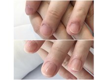 リーフ(Leaf)の雰囲気（育成ネイルケアで3ヶ月経てば見違える爪に変化）