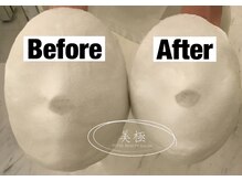 美極 トータルビューティー(美極 TOTAL BEAUTY)/恵比寿/小顔コルギ/エステ/