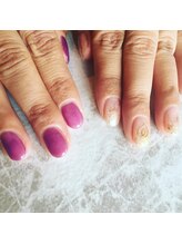 ロングフォー(long for)/