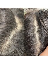 シュール センター南(SURREAL)/ヘッドスパ後のビフォーアフター