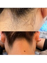 ウミ(Ummi)/うなじワックス