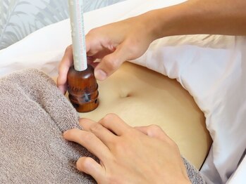 鍼灸整体院 陽(HARU)/妊活/産後/更年期へのお灸風景