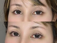 デリコ アイ(DELICO eye)/