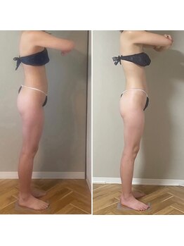 ラフォクシー(La.Foxy)/30代女性　週1×４回後の通い方