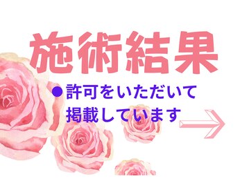 スマイルデイズ(Smiledays)/結果が出るから続けられるサロン