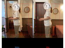 チャチャエイム整骨院 鍼灸院/骨盤矯正ビフォーアフター