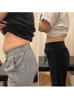 ナオ接骨院(NAO接骨院)/Before/After