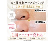 ウル(Uru)