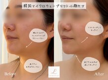 リル ビューティー ラボ(LILU BEAUTY LAB)