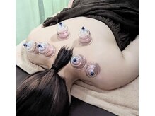 ブレッシングス(BLESSINGS)/カッピング