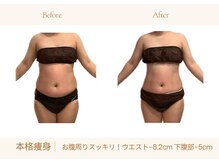 アランルージュ(ALANROUGE)/劇的★ビフォーアフター